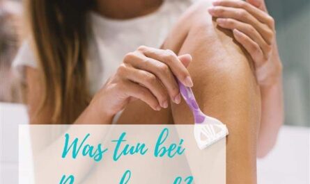 Was tun bei Rasurbrand? - Die perfekte Pflege nach der Rasur