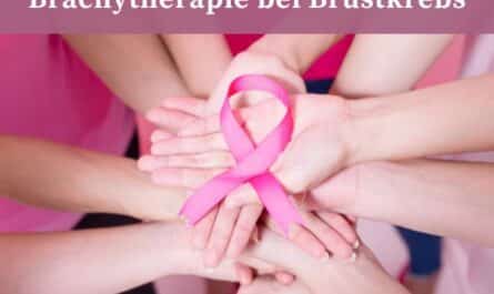 Brachytherapie bei Brustkrebs